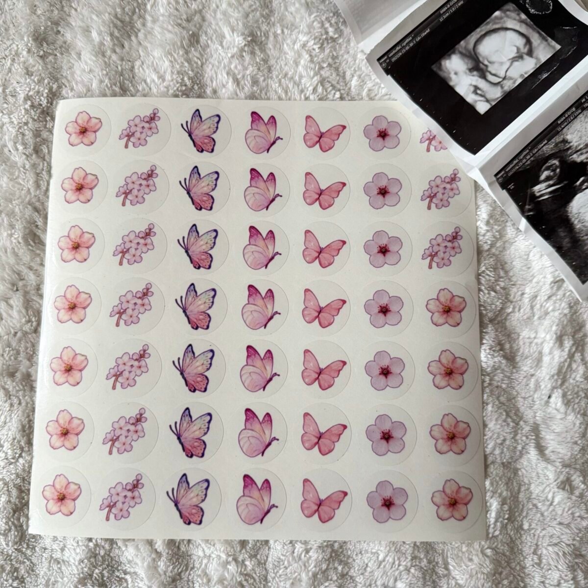 sticker sheet for ultrasound
