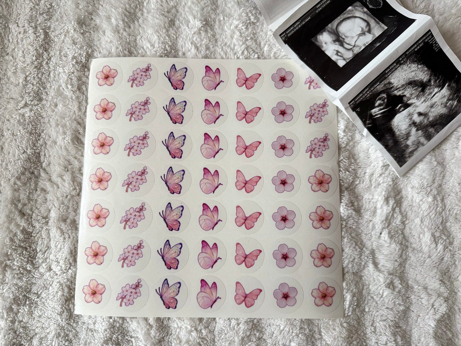 sticker sheet for ultrasound